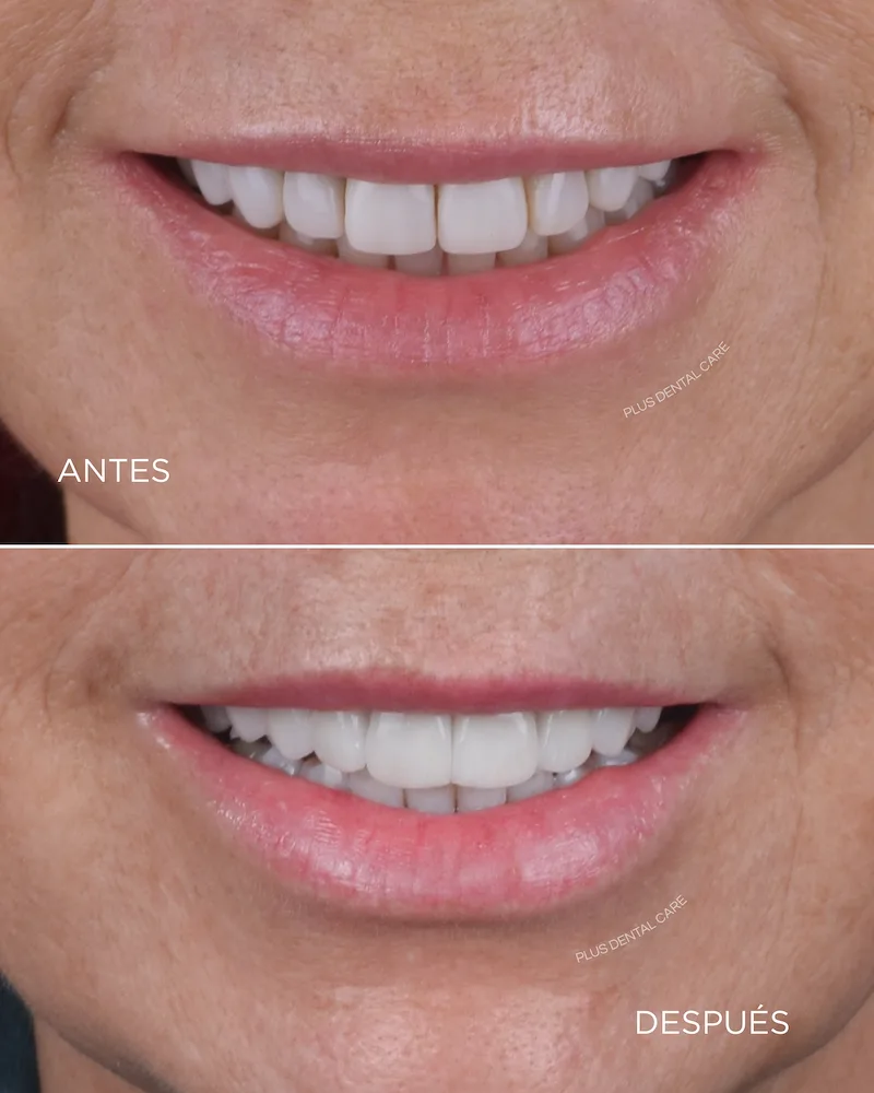 Caso de éxito de Plus Dental Care