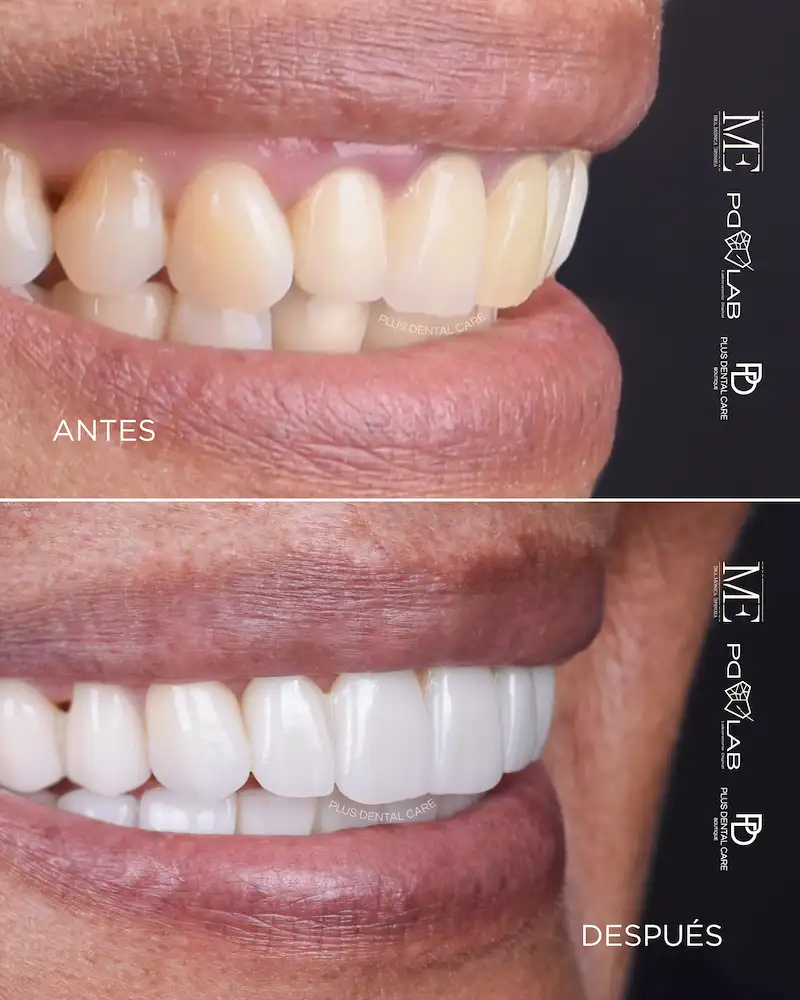 Casos de éxito de Plus Dental Care