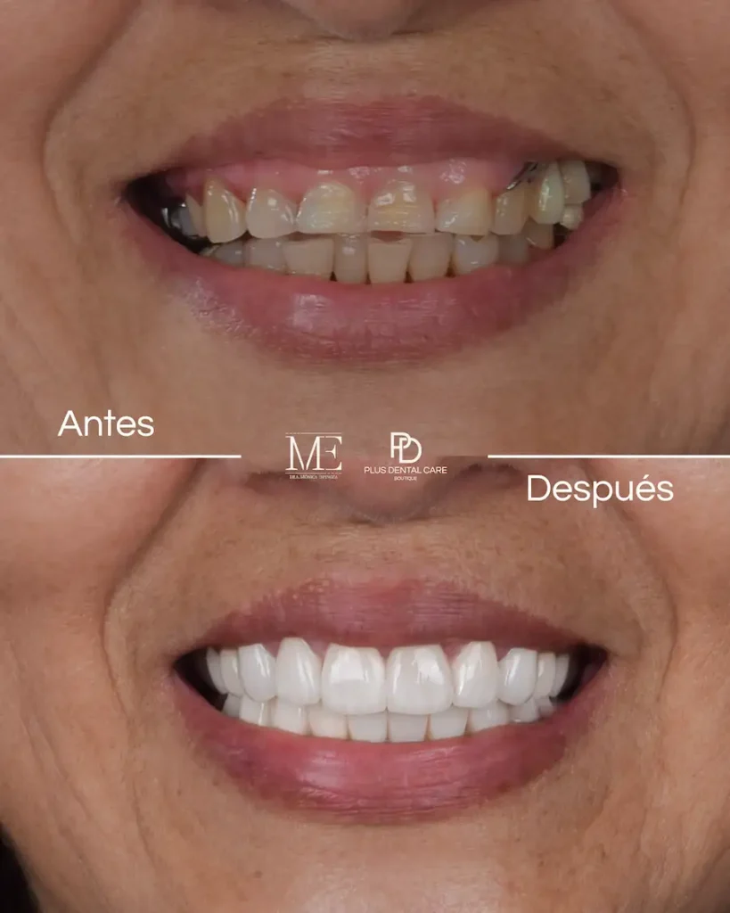 Recupera la seguridad con Plus Dental Care