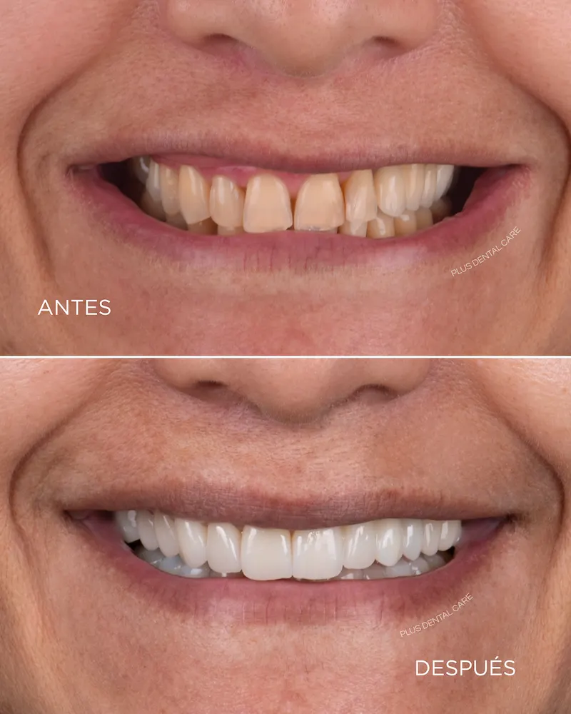 Resultados positivos de Plus Dental Care