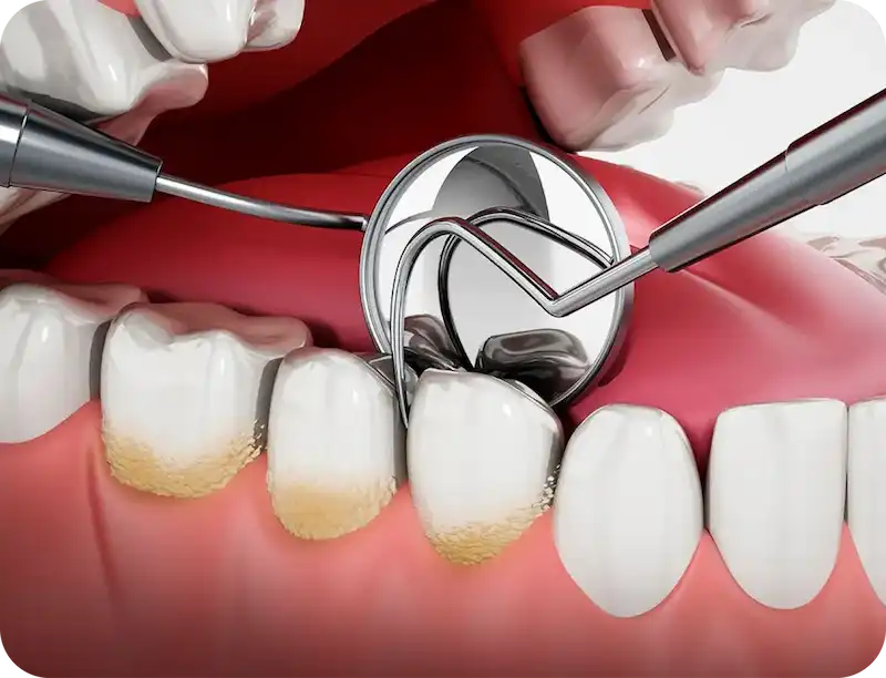 Proceso de revisión bucal durante el tratamiento de periodoncia