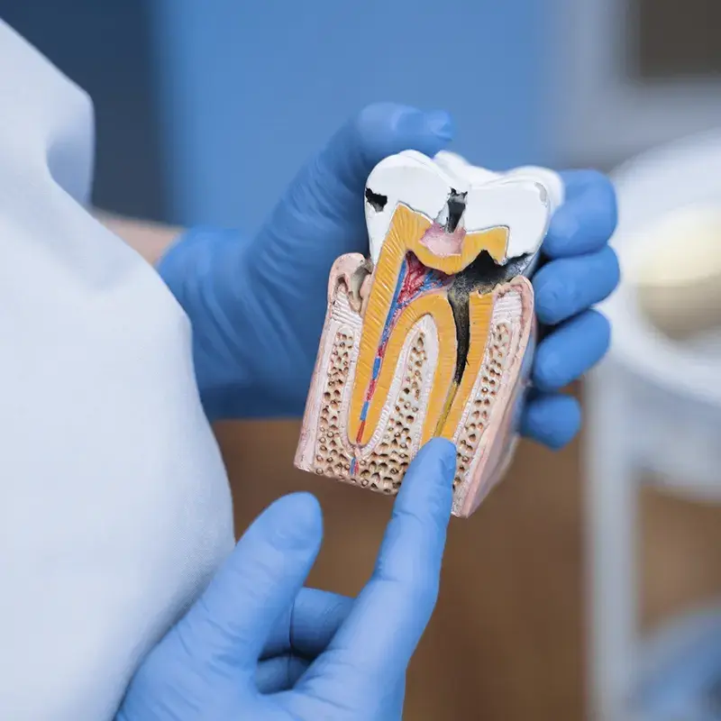 Señales de que podrías necesitar una endodoncia