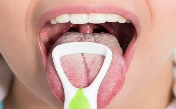 Es normal tener la lengua blanca Conclusión clara