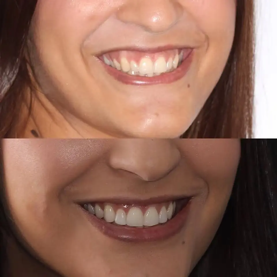 Estos son los mejores consejos para tener una bonita sonrisa