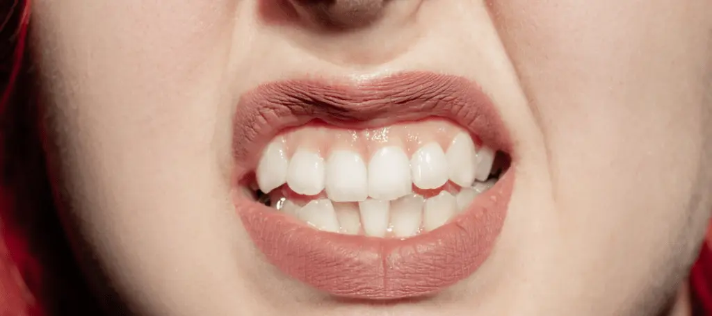 Dientes afuera