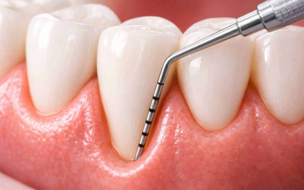 Diagnóstico periodontal completo