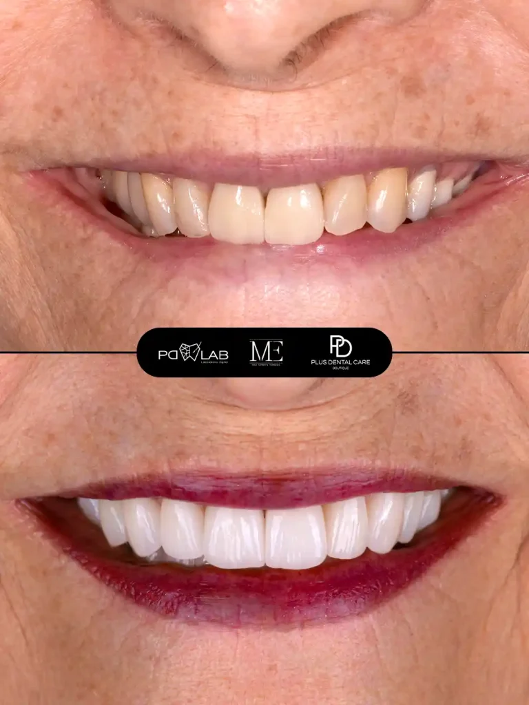rehabilitación oral