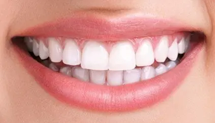 Blanqueamiento dental