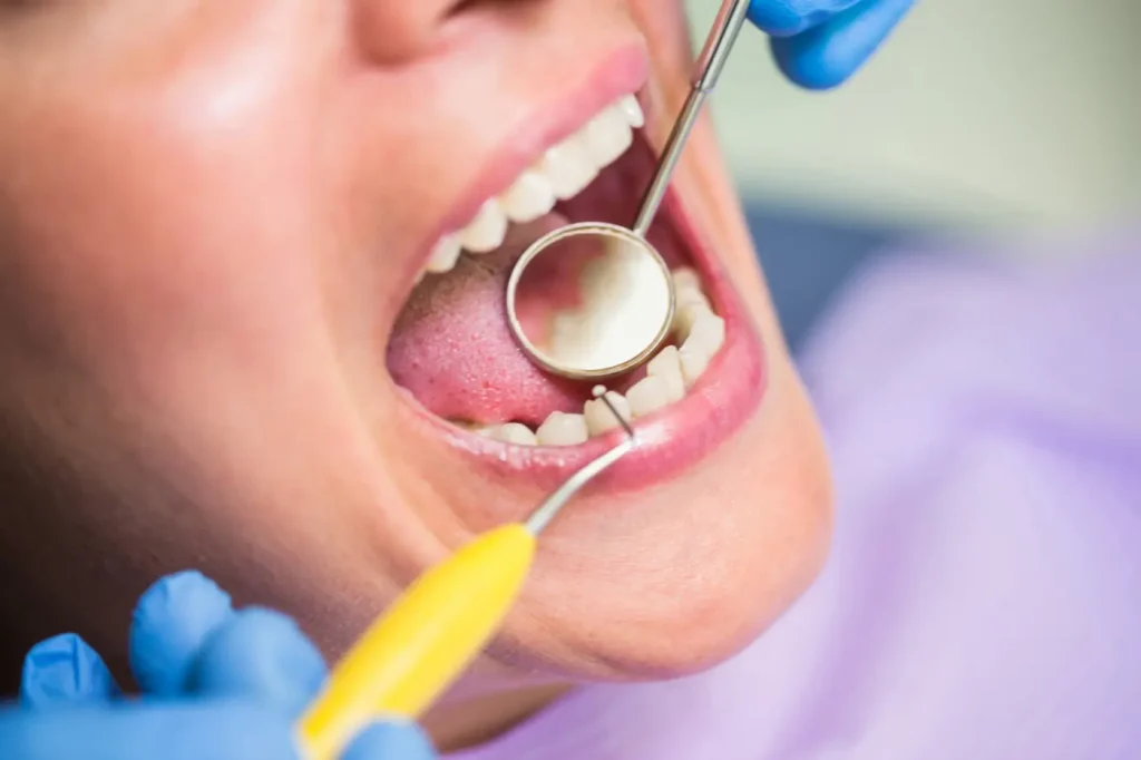 persona teniendo una consulta dental