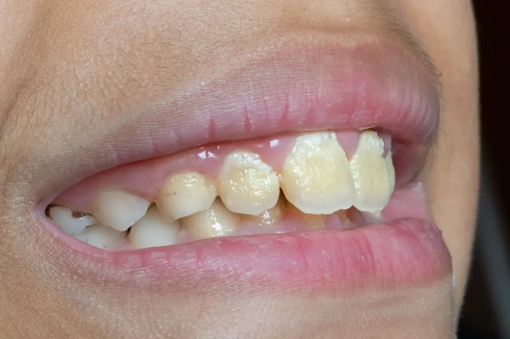 sarro dental
